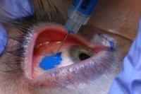 eyeball_tattoo_picture